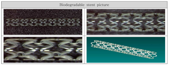 Biodegradable stent picture