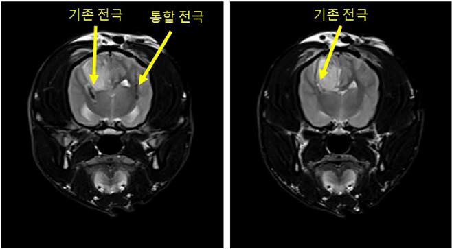 기존 전극과 개발된 통합 전극의 목표 구조물 접근도 비교 기존 전극 변형을 확인할 수 있음.