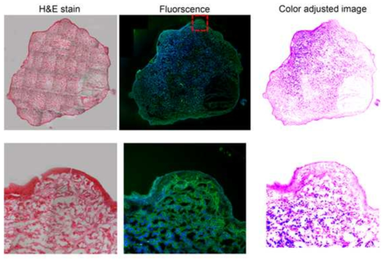 Cryotome으로 slice한 종양 조직의 H&E 염색한 것을 광학현미경으로 촬영한 것(왼쪽)과 형광 영상(가운데 사진) 비교.
