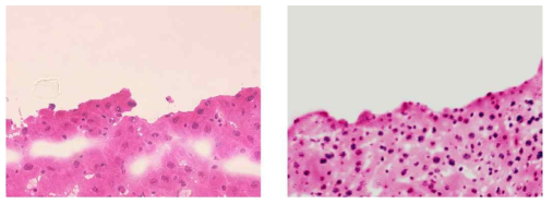 H&E 조직검사 영상(左), Pseudocolor 공초점 현미경 영상(右)