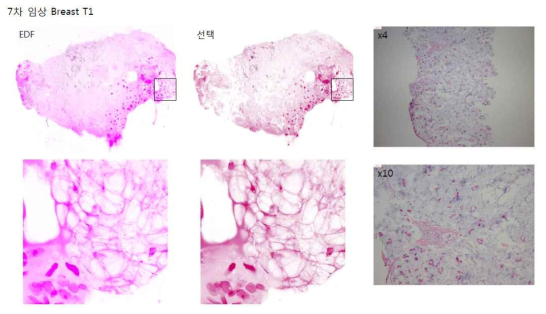 7차 Breast Tumor1 개발 장비(左, 中) 이미지 및 광학현미경 이미지(右)