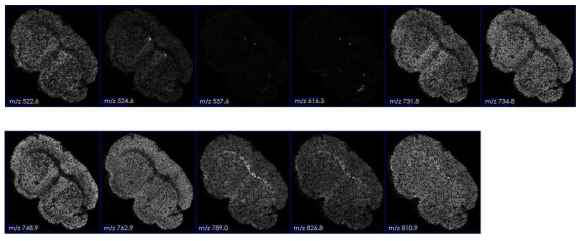 Brain tissue 의 질량이미지