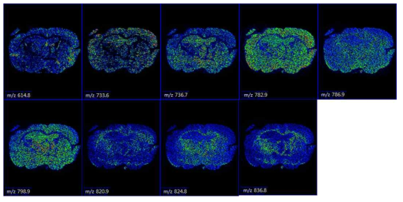 이미징 2 차의 brain tissue 질량이미지