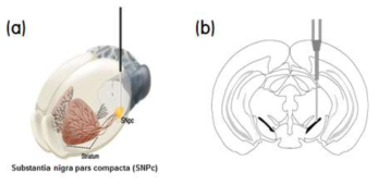 파킨슨 질환 모델마우스의 뇌 조직모델 (a) 과 단면 (b) 검은색으로 표시된 부분이 이번 연구의 타겟인 흑색질