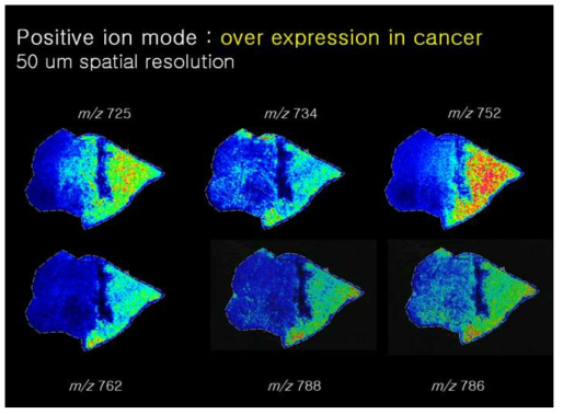유방암 조직에 대한 지질 MALDI 이미징 분석결과 종양부위에서 많이 발현되는 지질 이미징 결과