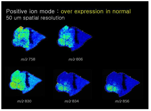 유방암 조직에 대한 지질체 MALDI 이미징 분석결과 정상부위(근육조직)에서 많이 발현되는 지질 이미징 결과