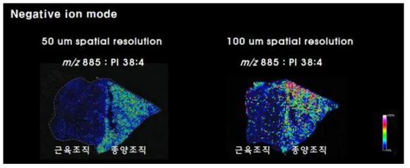 음이온 모드에서의 유방암 조직에 대한 지질 MALDI 이미징 분석결과