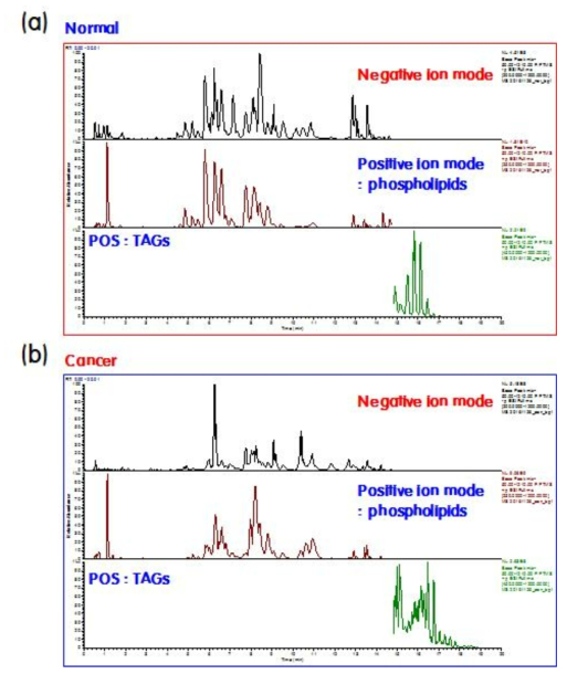 정상부위 (근육조직) 와 유방암 조직에 대한 UPLC/MS 크로마토그램