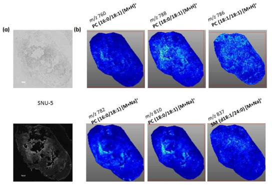 위암 (SNU-5) 조직에 대한 MALDI 이미징 분석 결과