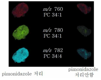 MALDI imaging 의 분석 차이