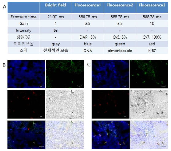 복합적인 표적 항체를 사용한 형광현미경의 관찰