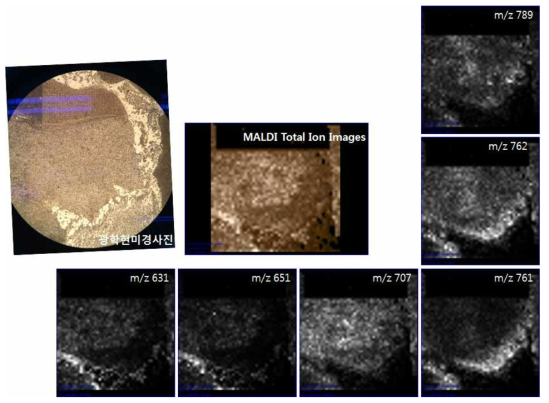 제작된 MALDI 이미징 장비로 얻은 티슈 질량 이미지 3