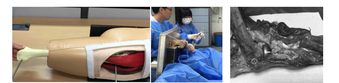 대퇴골 절골술 모형 실험, 카데바를 이용한 도구 유용성 실험 및 인공 관절 치환술 실험
