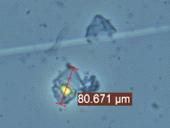 H.Triquetra 현미경 사진