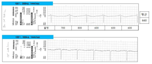 100도/350kgf, 150도/200kgf와의 형상 비교