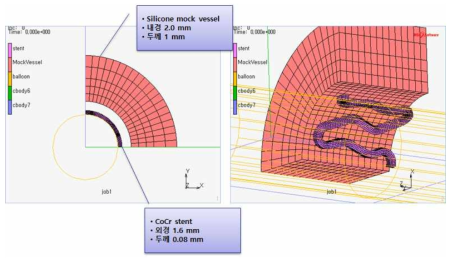 CoCr 합금 스텐트의 내구 해석 모델