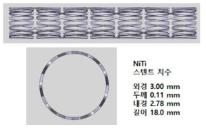 NiTi 스텐트의 형상 및 치수