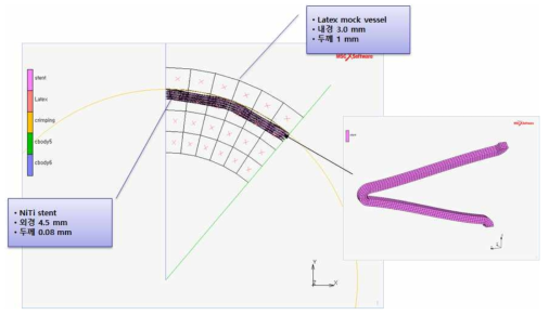NiTi 합금 스텐트의 내구 해석 모델