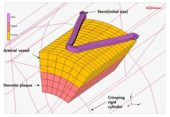 NiTi 합금 스텐트와 혈관의 내구 해석 모델