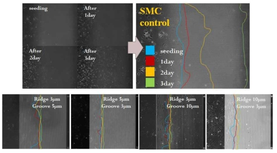 패턴 표면 위에서의 평활근세포 증식