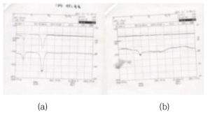 공진기 구성시 필요한 FBG 투과 스펙트럼