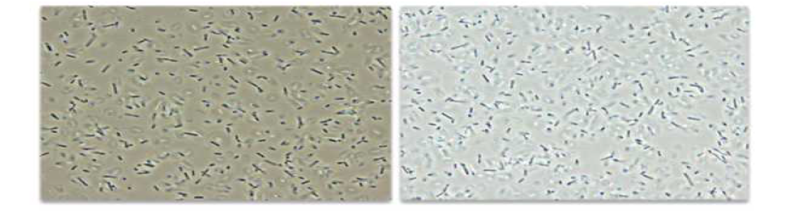 배양액의 B. amyloliquefaciens 5B6, B. subtilis 8D4의 내생포자