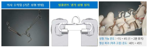 척추 임플란트 성형 방법 비교 (수작업 & 임플란트 냉각 성형 장치)