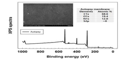 autopsy 분리막 SEM 및 XPS 결과