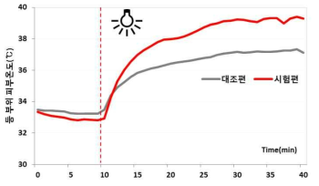 광원조사 시 등 부위 피부온도의 경시적 변화