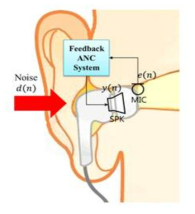 이어폰 소음 제어를 위한 Feedback 능동 소음 제어 시스템