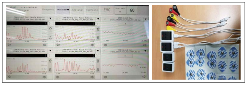 근전도 측정 시스템