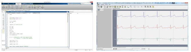 수면센서 분석용 Matlab 프로그램(좌) vs ECG 측정용 Telescan(우)