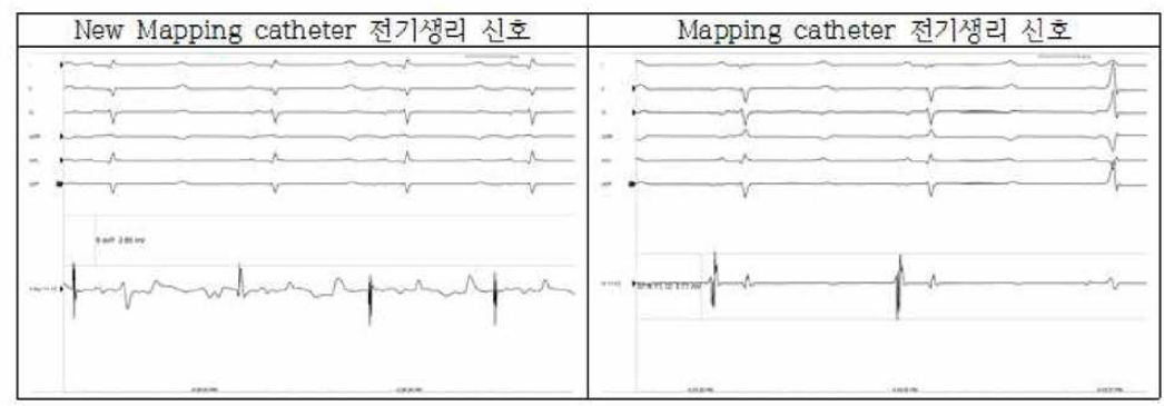 매핑카테터의 전기생리 신호