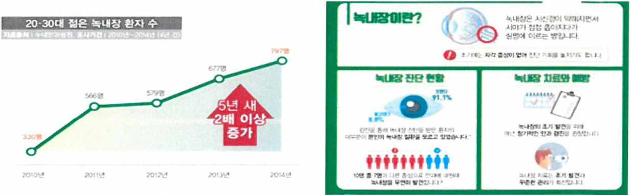 누네안과병원 20, 30대 녹내장 환자 수 조사결과