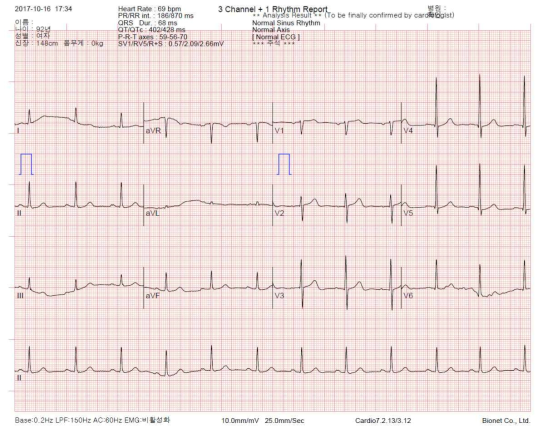 CARDIO 7으로 측정한 심전도의 파형