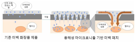 용해성 마이크로니들 기반 국소 미백 패치와 기존 미백 화장품 비교