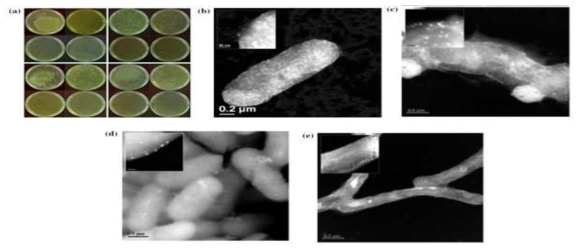 은나노입자의 항균성을 나타내는 사진과 주사전자 현미경(SEM) 사진