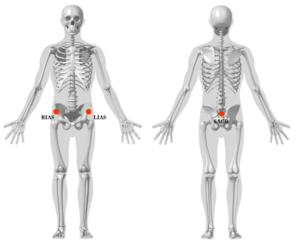 ASIS(Anterior Superior Iliac Spine) 마커 위치