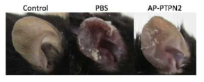 유도 접촉성 피부염 모델에서 AP-PTPN2에 의한 귀 두께 저해 효과