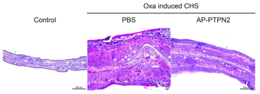 유도 접촉성 피부염 모델에서 AP-PTPN2에 의한 귀 두께 저해 효과 조직학적 분석
