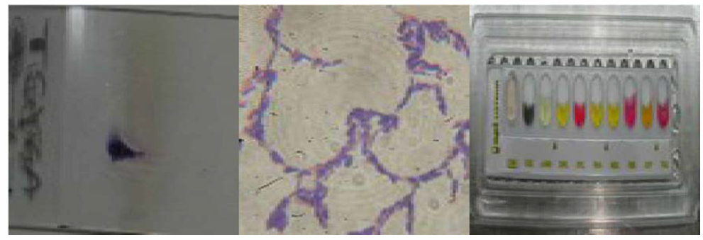리스테리아균(Listeria monicytogenes) 확인시험 (그람염색，API LISTERIA)