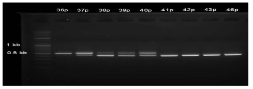 37P에서 41P 사이에서 ORF1ab gene의 결손 과정을 확인한 RT=PCR