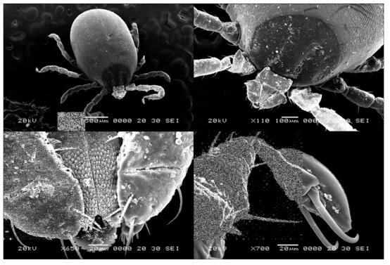 채집한 진드기 전자현미경 사진
