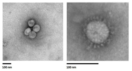 분리된 PDCoV 입자의 전자현미경 관찰