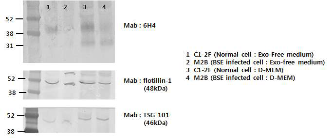 BSE지속감염세포(M2B) 및 소 프리온 발현세포(C1-2F) 상층액에서 분리한 exosome