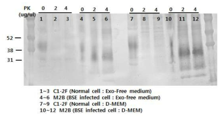 exosome내 프리온의 단백분해효소 감수성 검사 결과