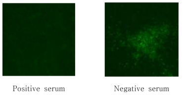 양성 및 음성혈청을 이용한 FA-VN 결과 비교