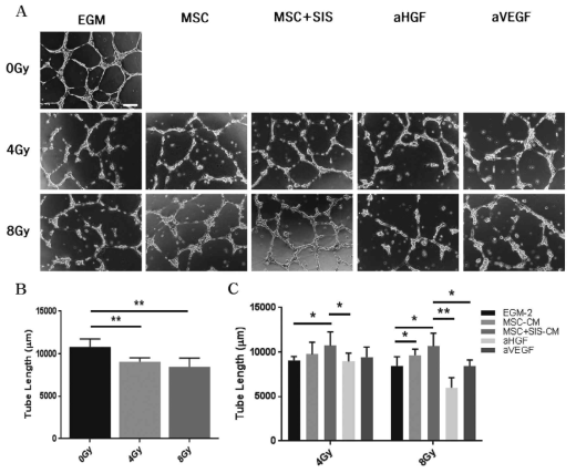 분비배지 유래 성장인자의 방사선 피폭 HUVEC tube-like structure formation 회복 효과