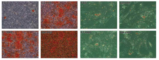 PRP 활성화 방법에 따른 MSC 분화능 변화