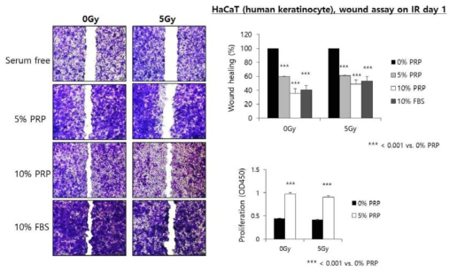 PRP의 방사선 피폭 상피세포의 Wound healing 분석 결과